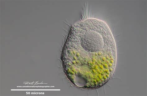  İyotrichium! An Intriguing Ciliate With Shimmering Threads