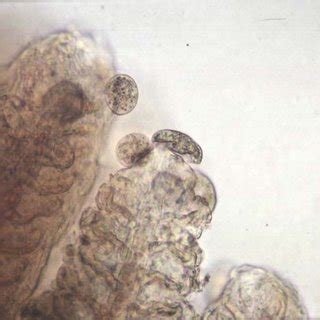  Ichthyophthirius Multifiliis: Bir Protozoanın Gizemli Dünyası!